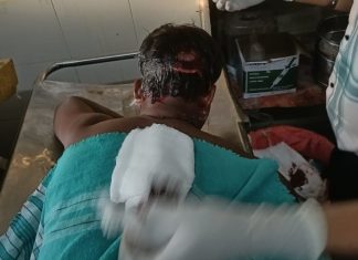ब्रेकिंग न्यूज… — अस्वलाच्या हल्ल्यात शेतकरी गंभीर जखमी..